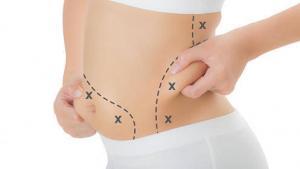 mesoterapia madrid clinica estetica mesoterapia madrid