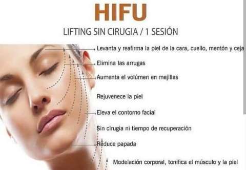 hifu facial