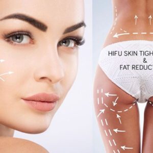 resultados hifu madrid